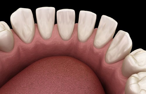 Illustration of gapped teeth