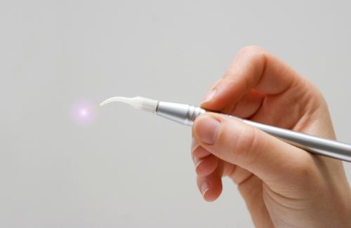 Hand holding a metal dental laser pen