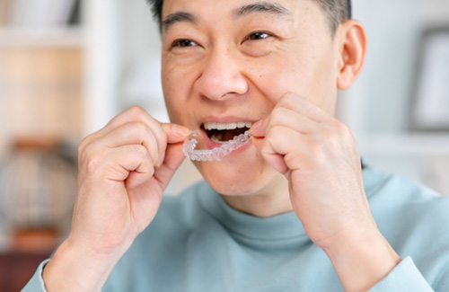 Patient putting on clear aligner