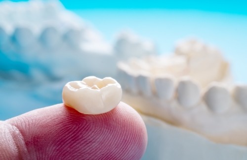 Dental crown resting on a finger