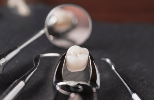 Dental forceps holding a tooth after wisdom tooth extractions in West Jordan